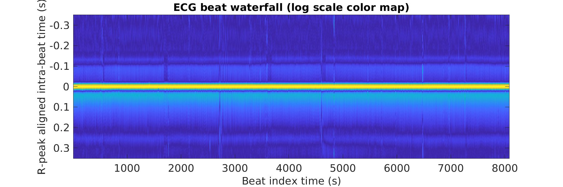 S012_ecg_beats_waterfall_logscale