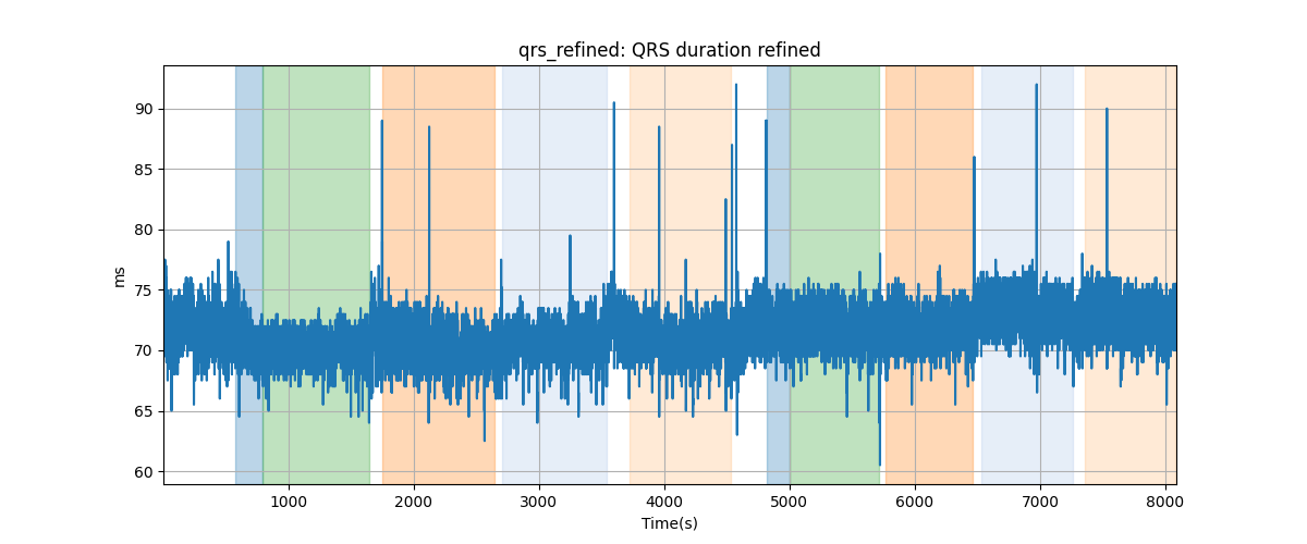 qrs_refined: QRS duration refined