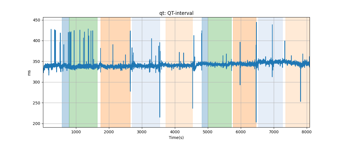 qt: QT-interval