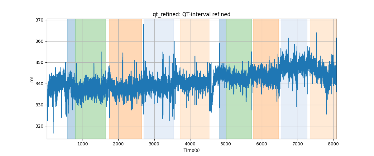 qt_refined: QT-interval refined