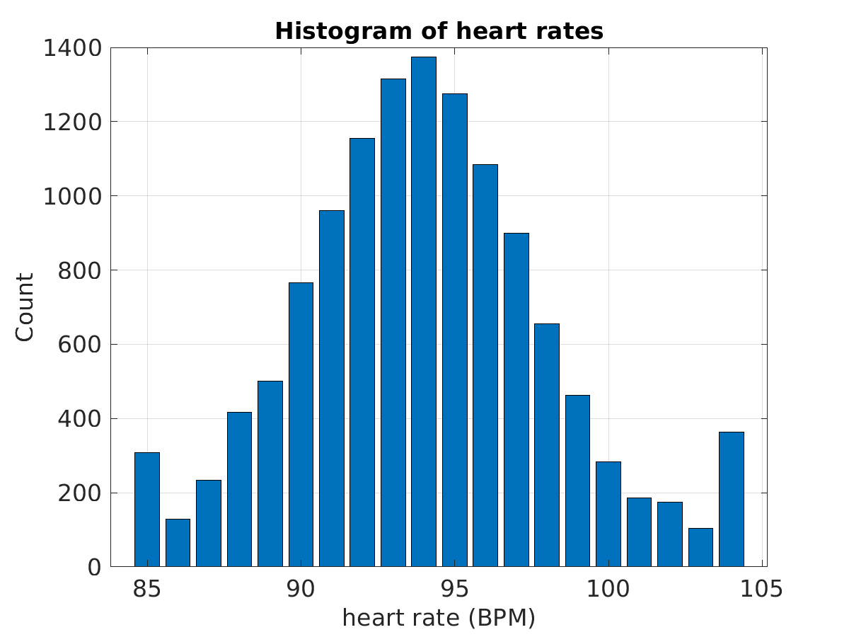 S012_ecg_hr_hist