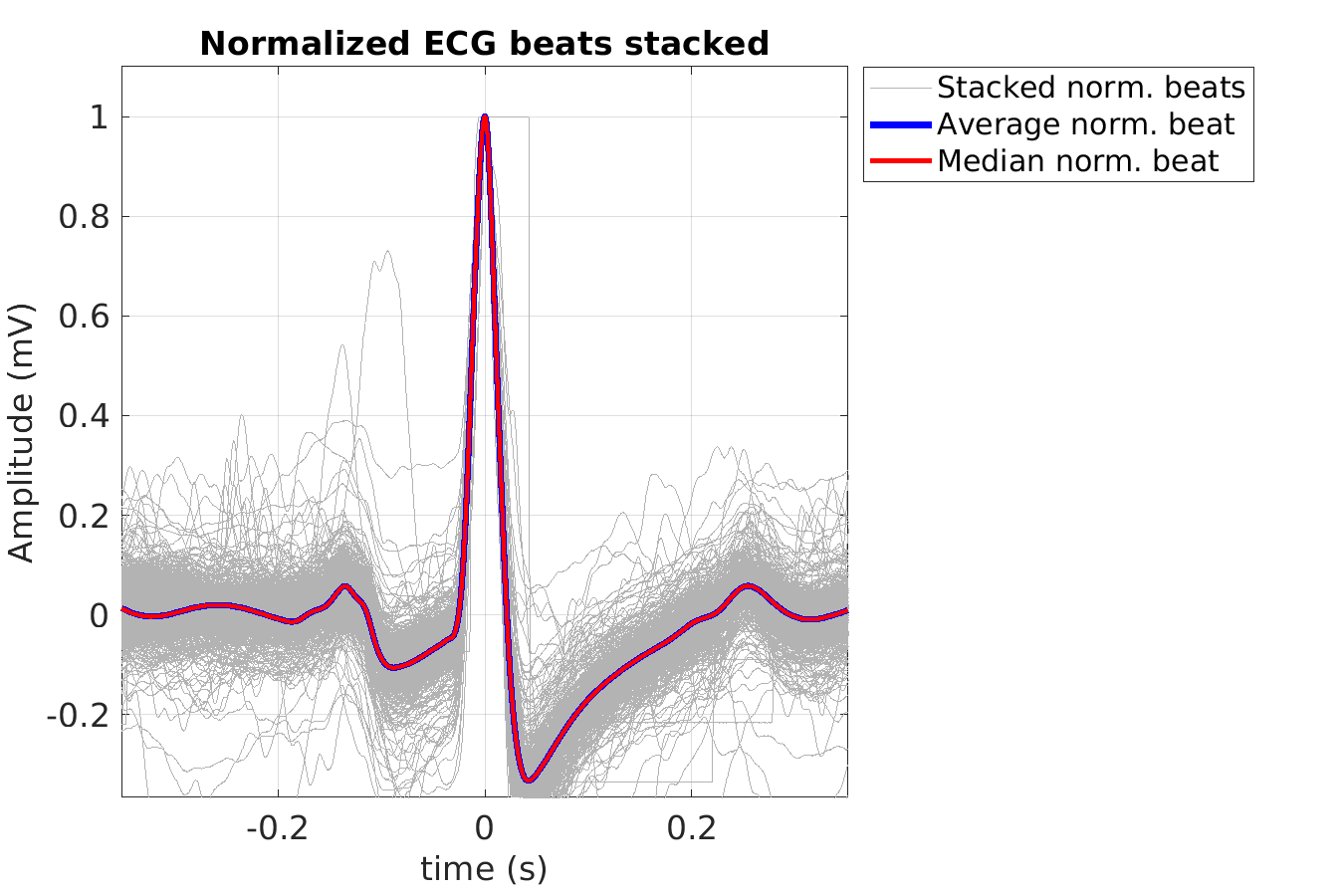 S012_ecg_norm_beats_stacked