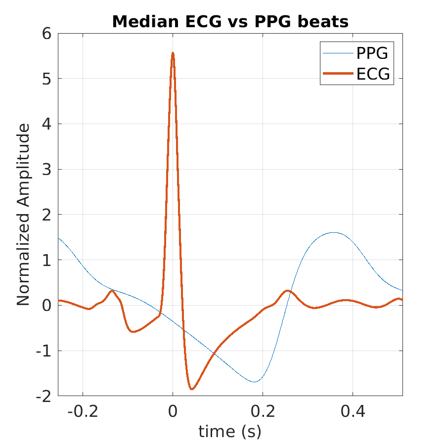 S012_ppg_med_ecg_ppg