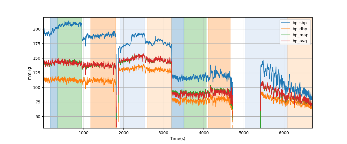 Subject S014 blood pressure data processing summary - Overlay