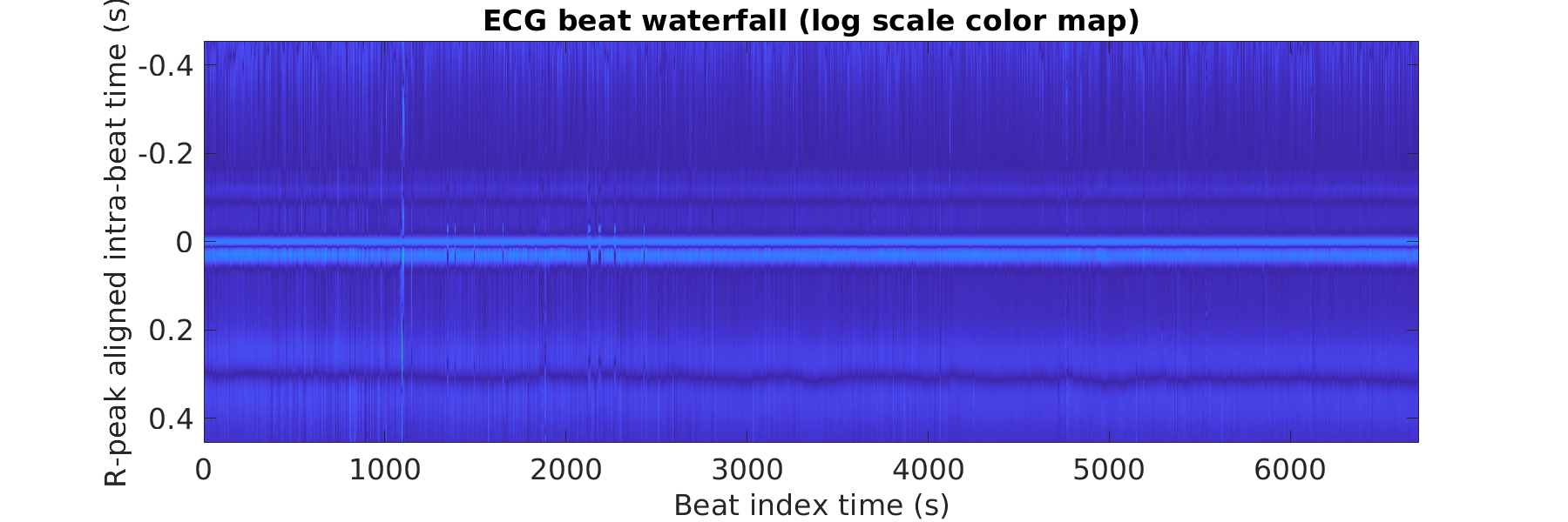 S014_ecg_beats_waterfall_logscale