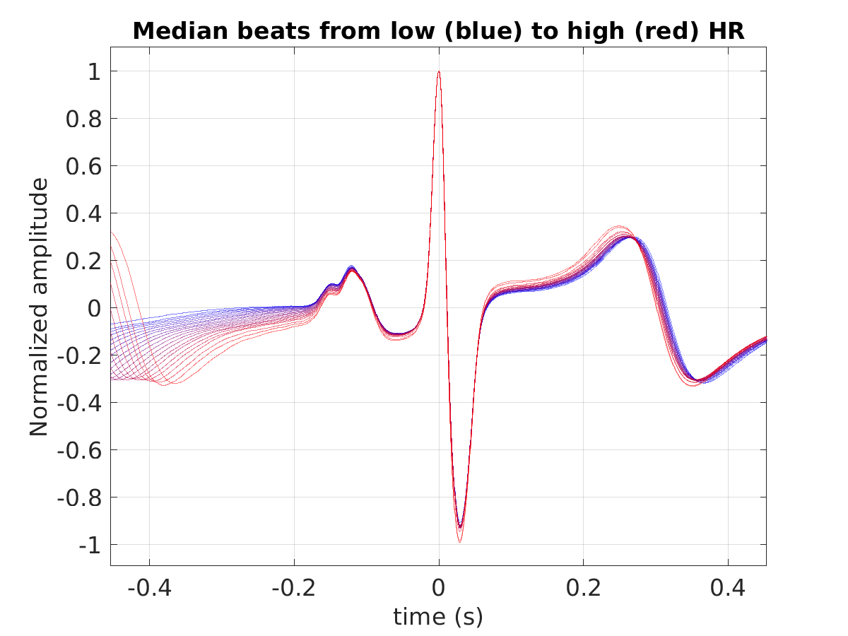 S014_ecg_med_beats_hr_binned