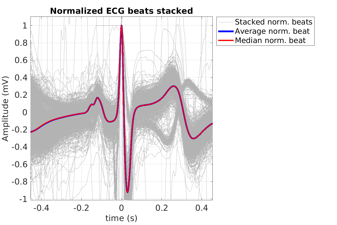 S014_ecg_norm_beats_stacked