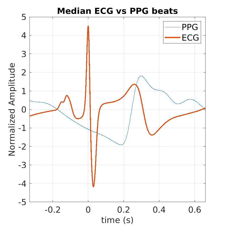 S014_ppg_med_ecg_ppg