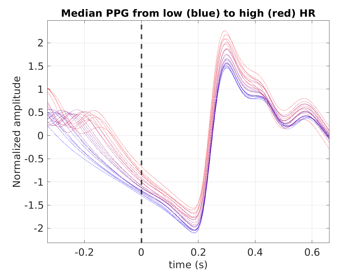 S014_ppg_med_ppg_hr_binned_norm