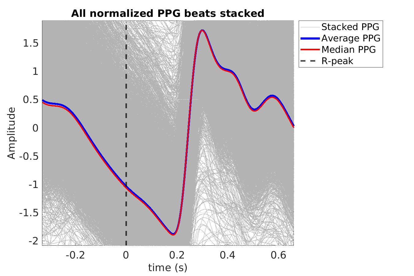 S014_ppg_ppg_stacked_norm