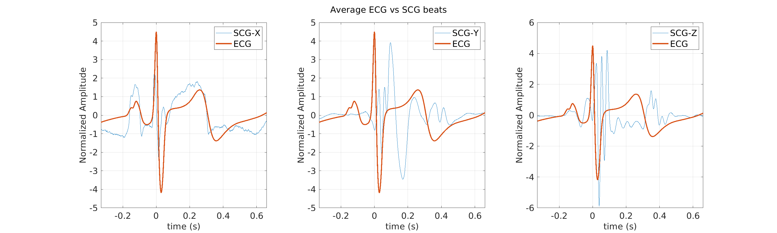 S014_scg_avg_ecg_scg