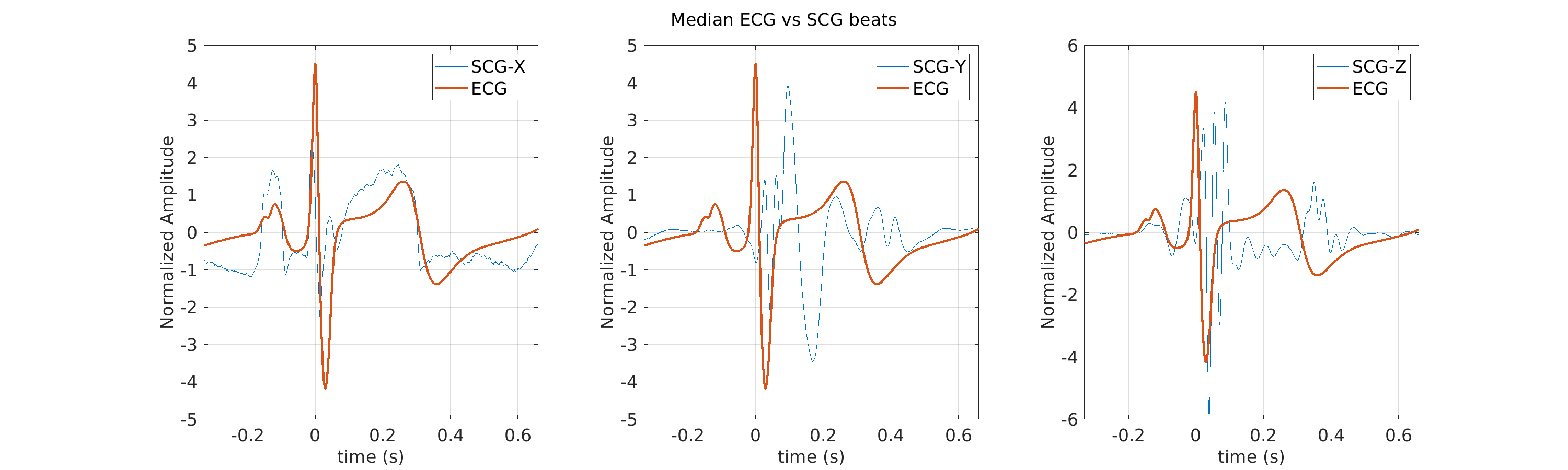 S014_scg_med_ecg_scg