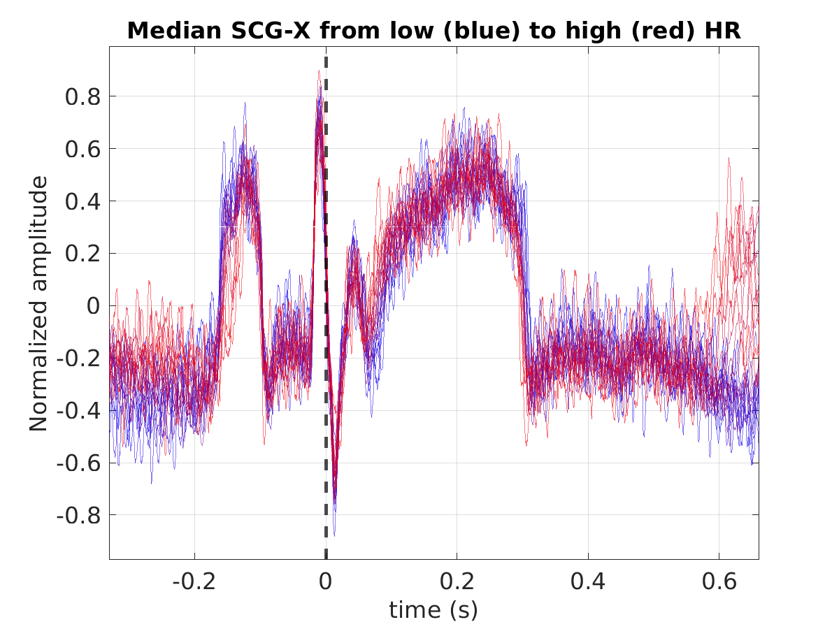 S014_scg_med_scgx_hr_binned_norm