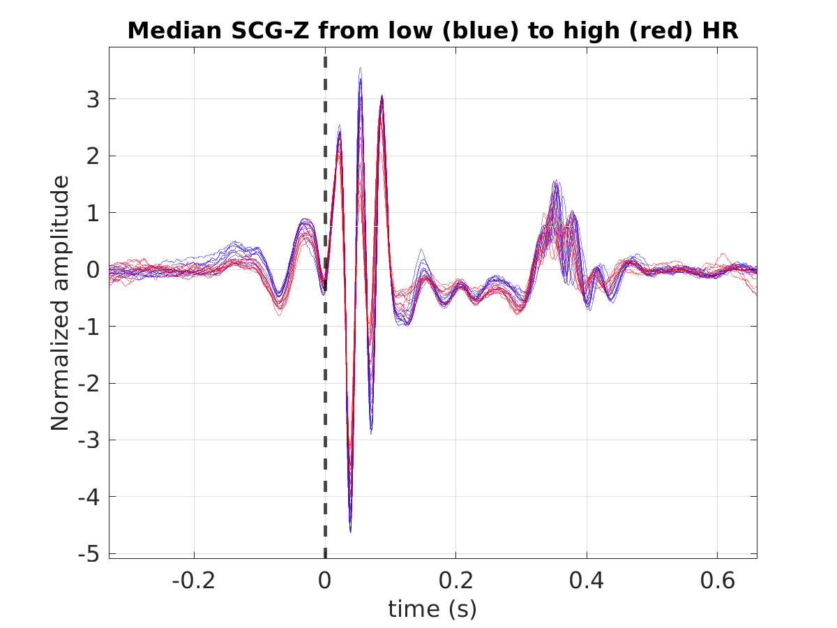 S014_scg_med_scgz_hr_binned_norm