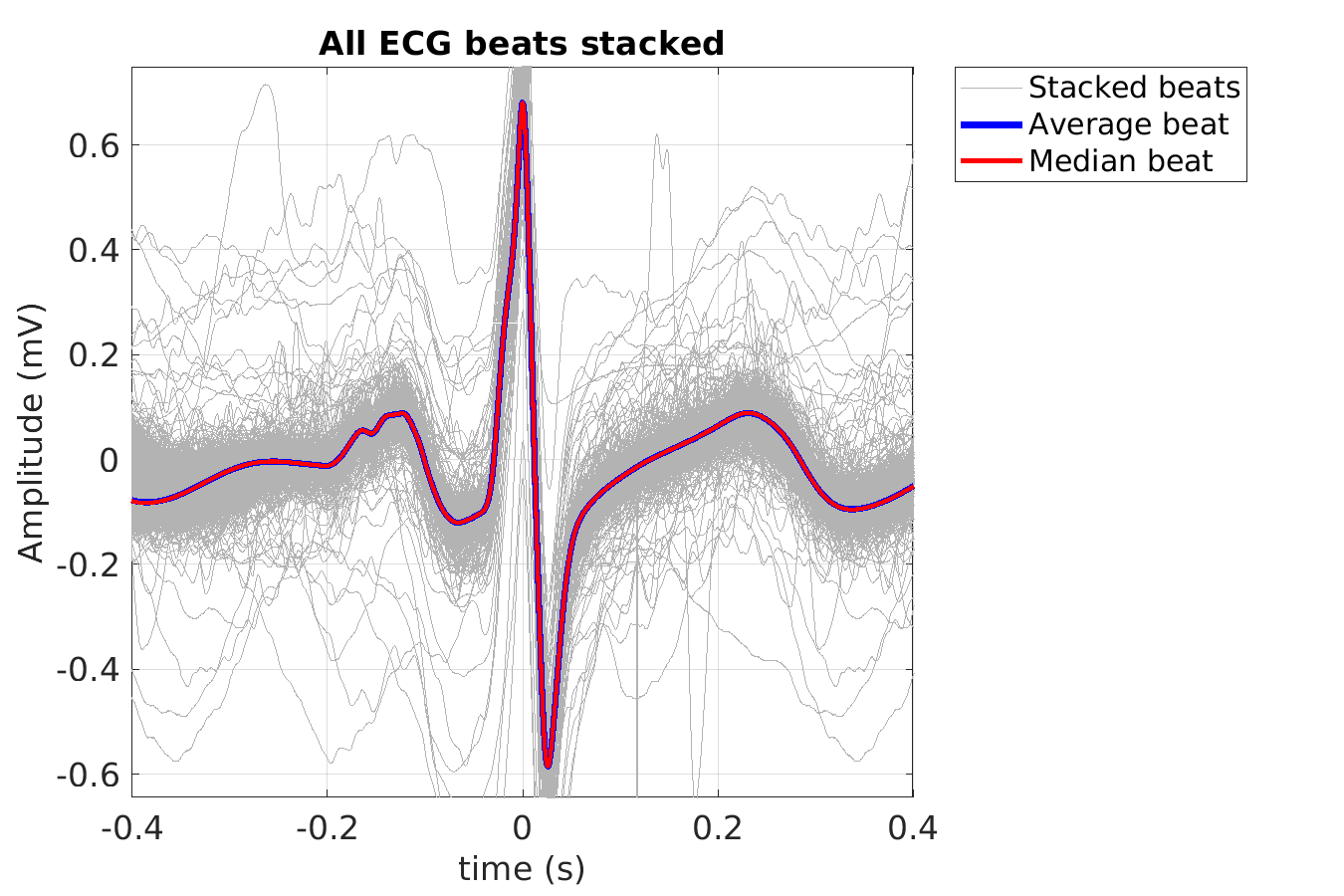 S016_ecg_beats_stacked