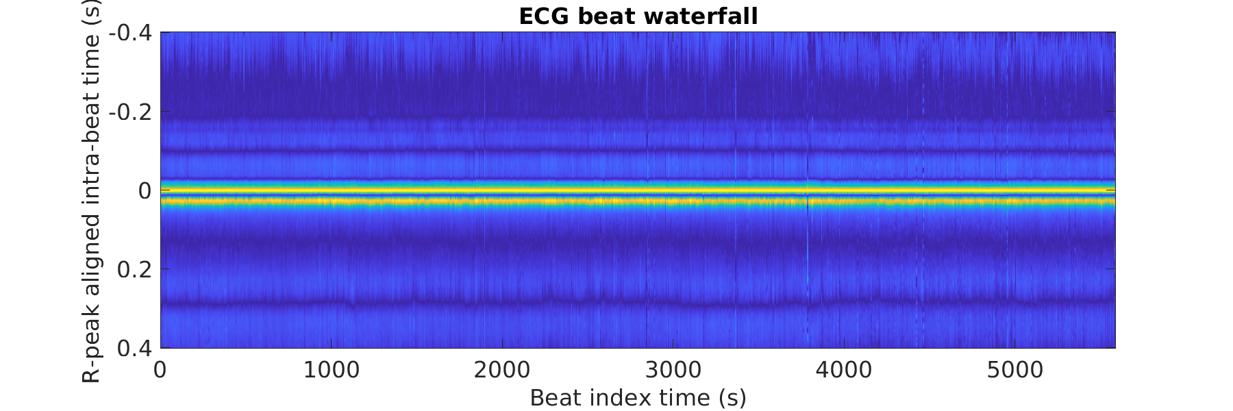 S016_ecg_beats_waterfall