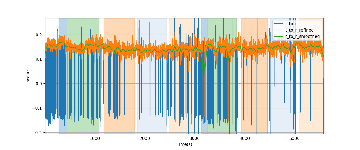 T/R wave ratio - Overlay