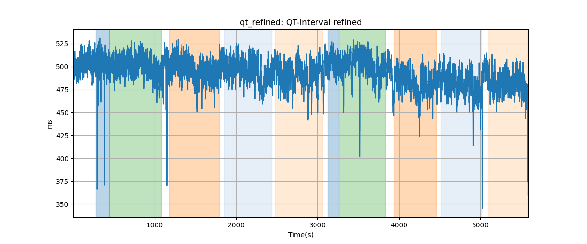 qt_refined: QT-interval refined