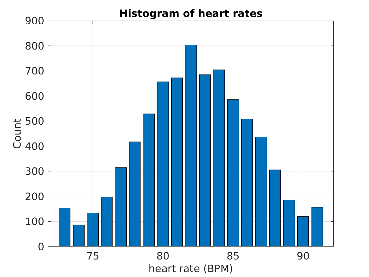 S016_ecg_hr_hist