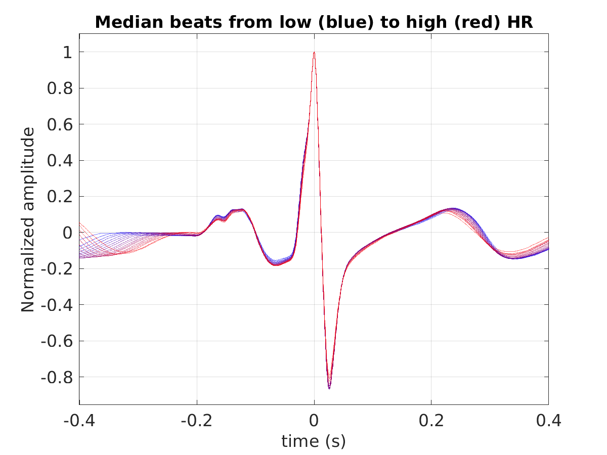 S016_ecg_med_beats_hr_binned