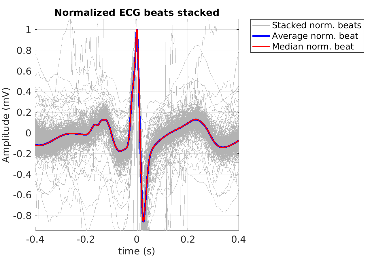 S016_ecg_norm_beats_stacked