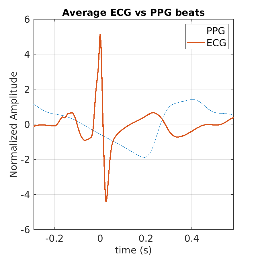 S016_ppg_avg_ecg_ppg