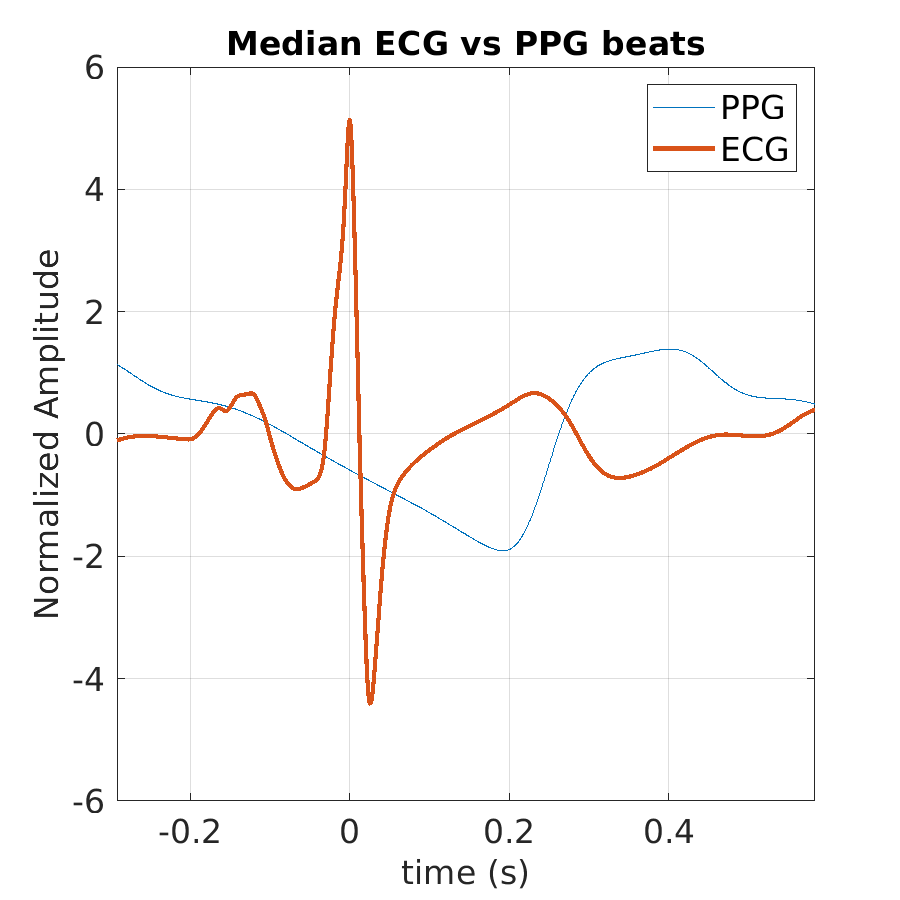 S016_ppg_med_ecg_ppg