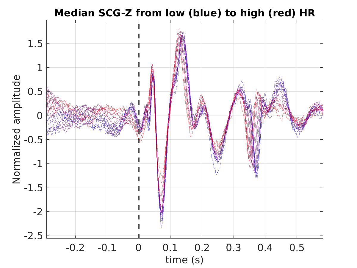 S016_scg_med_scgz_hr_binned_norm