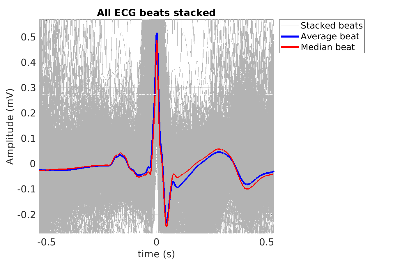 S019_ecg_beats_stacked