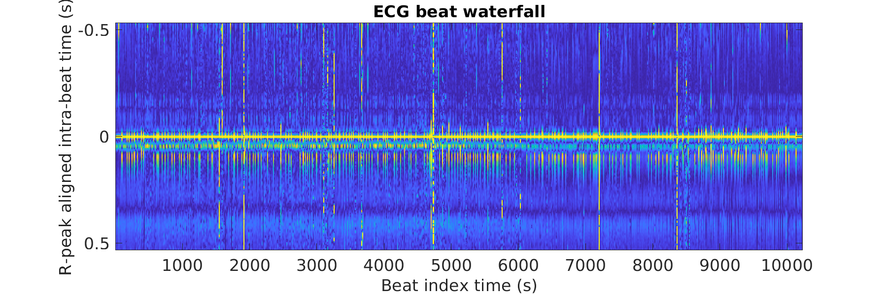 S019_ecg_beats_waterfall