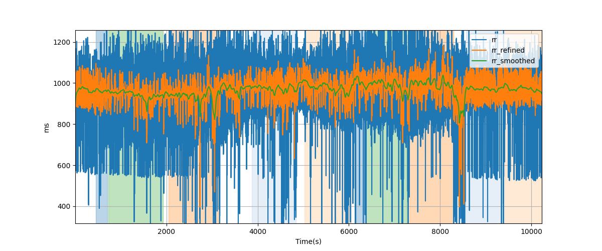 RR intervals - Overlay