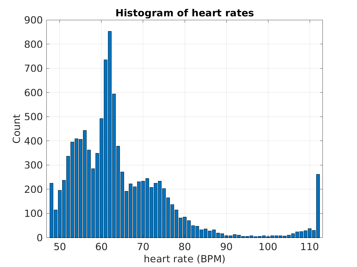 S019_ecg_hr_hist