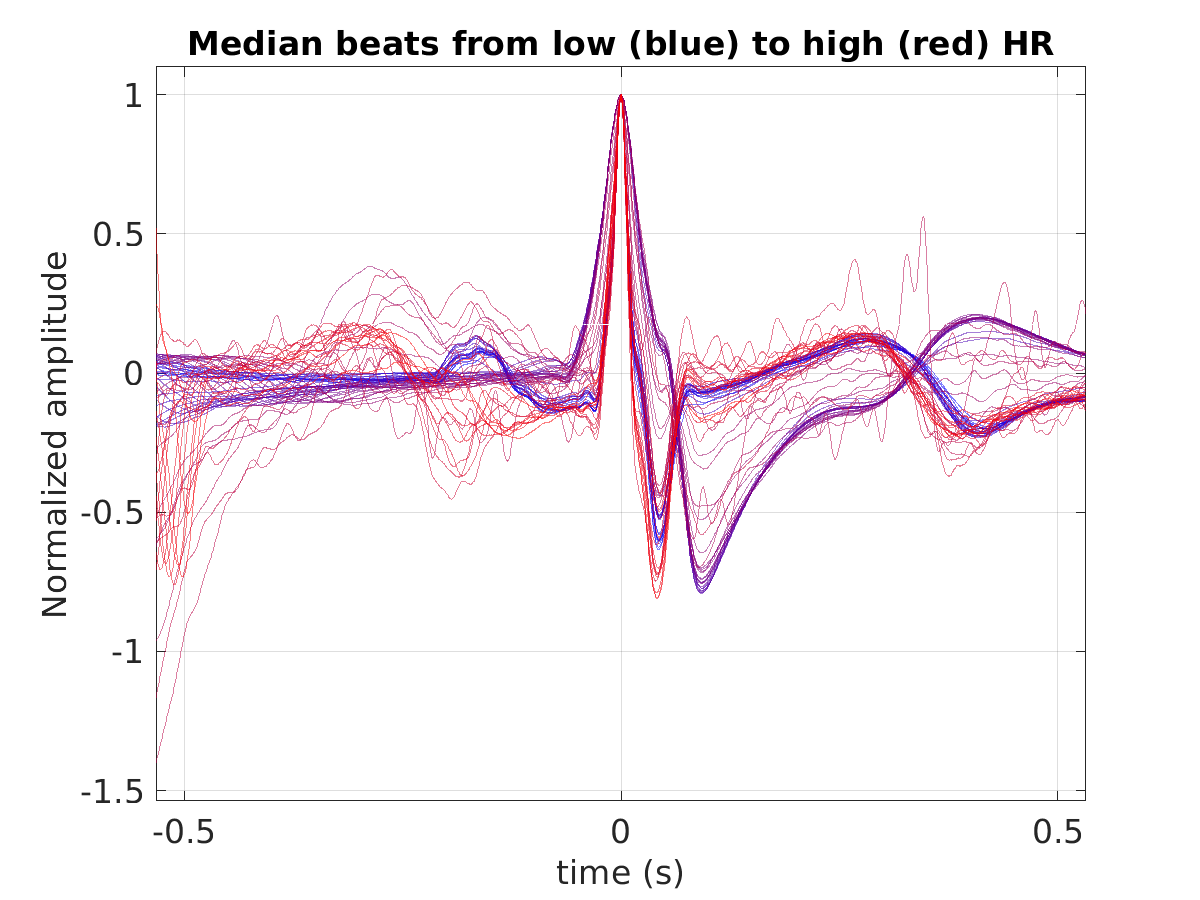 S019_ecg_med_beats_hr_binned