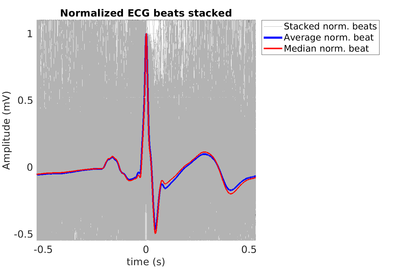 S019_ecg_norm_beats_stacked