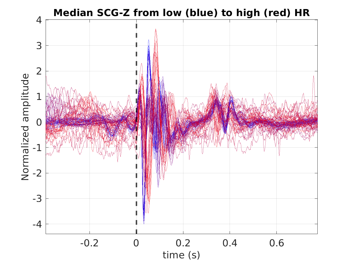 S019_scg_med_scgz_hr_binned_norm