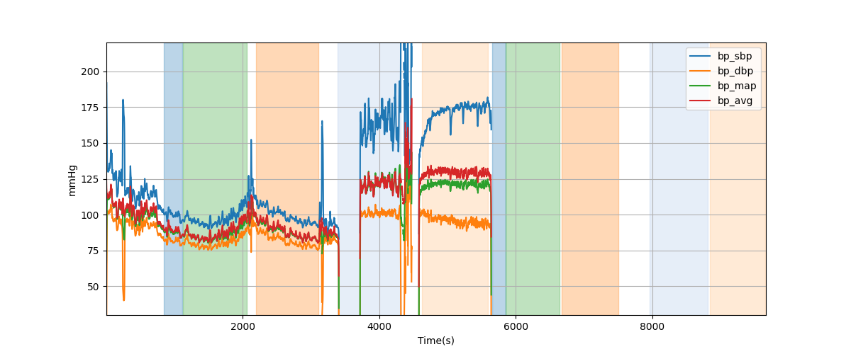 Subject S020 blood pressure data processing summary - Overlay