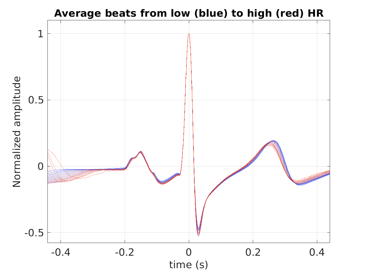 S020_ecg_avg_beats_hr_binned