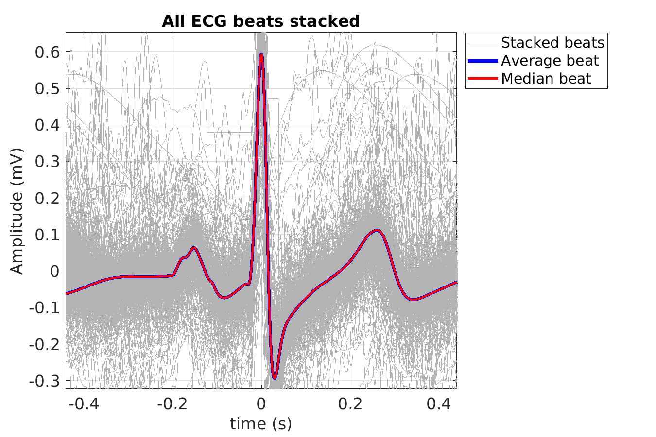 S020_ecg_beats_stacked