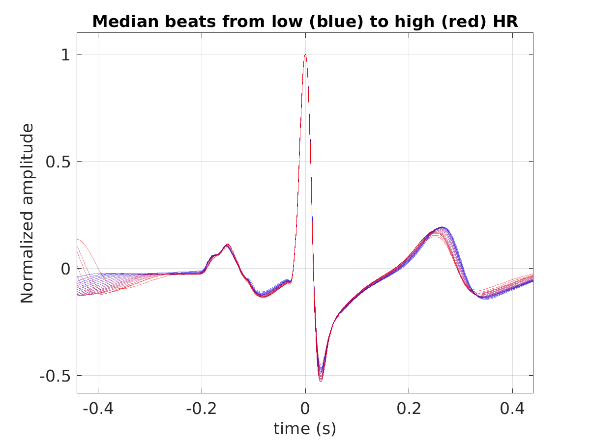 S020_ecg_med_beats_hr_binned