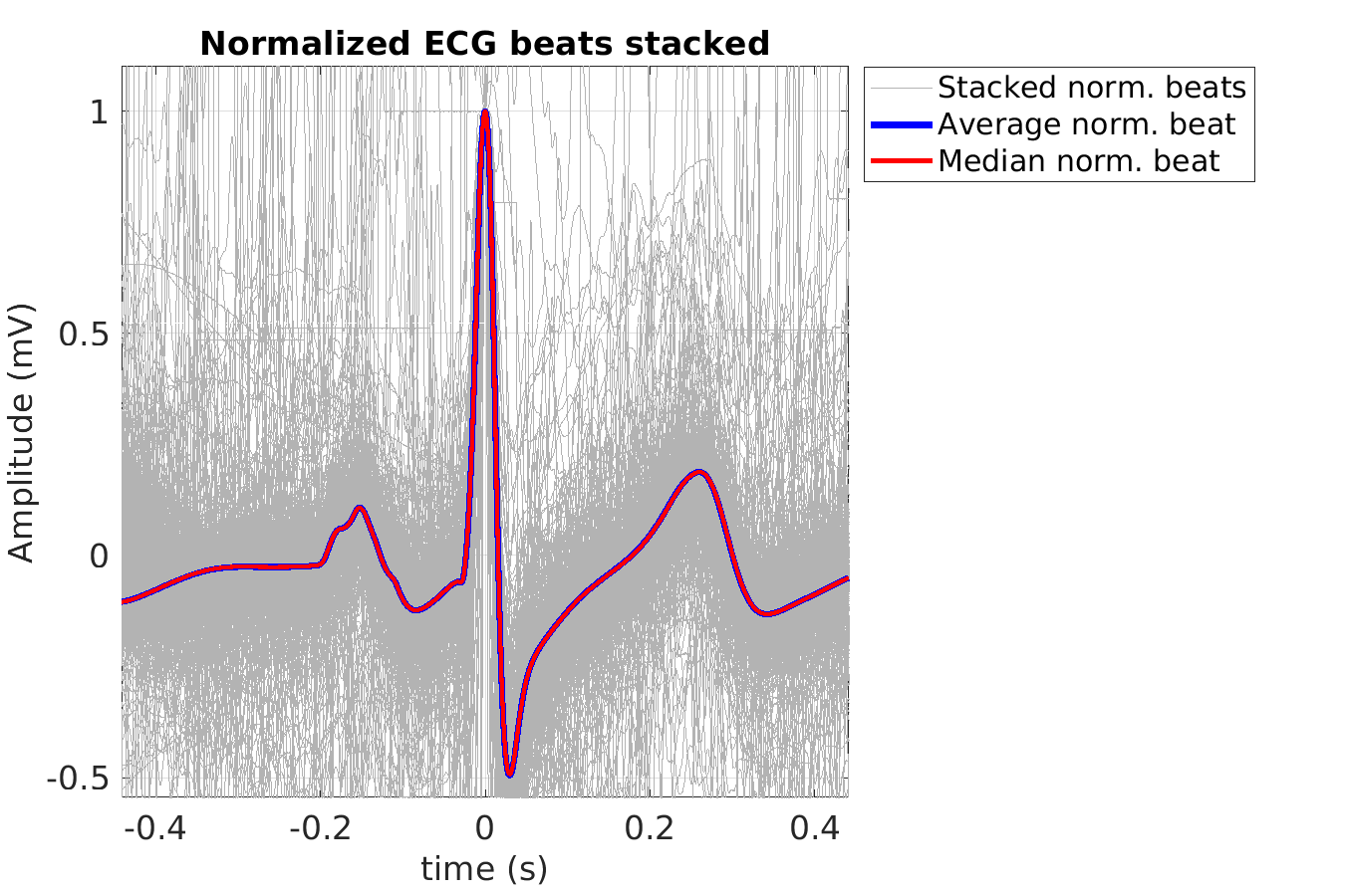 S020_ecg_norm_beats_stacked