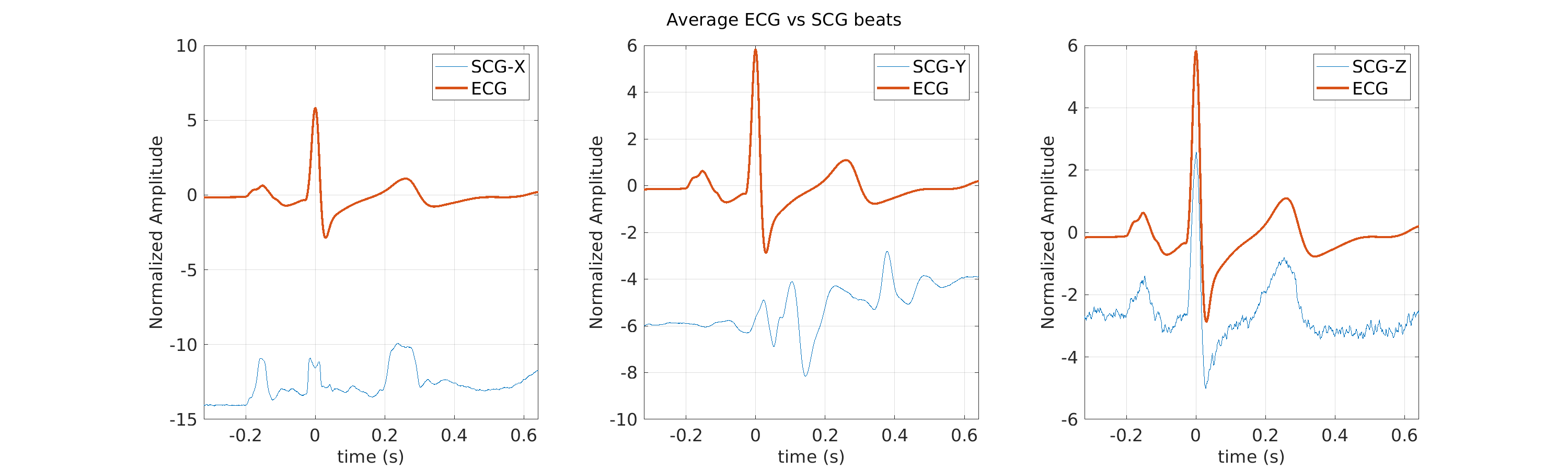 S020_scg_avg_ecg_scg