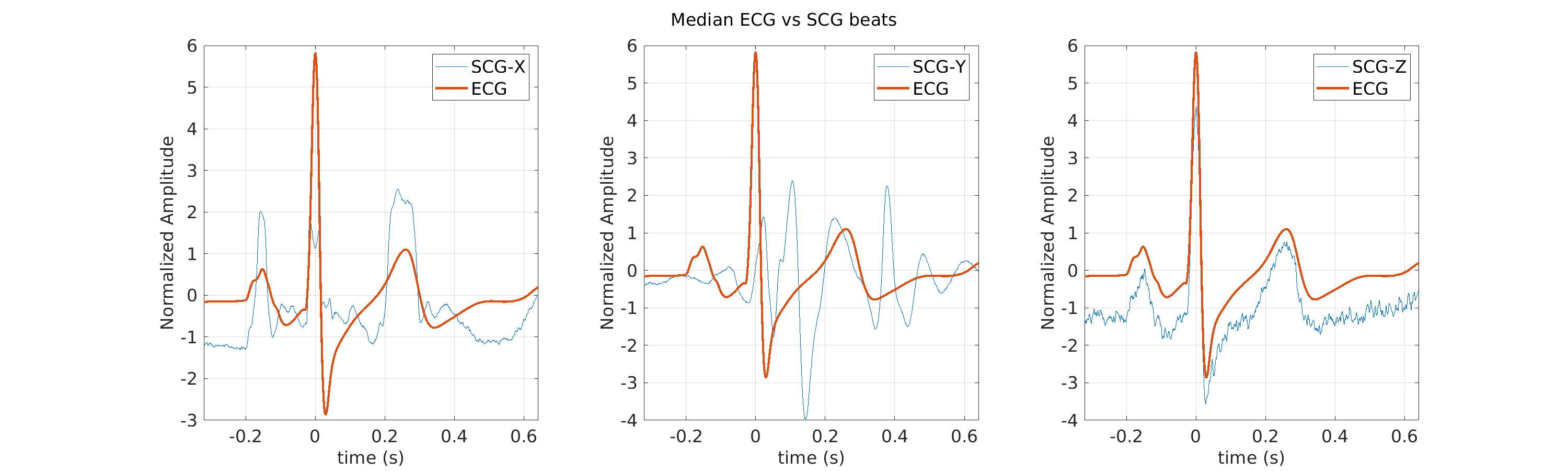 S020_scg_med_ecg_scg