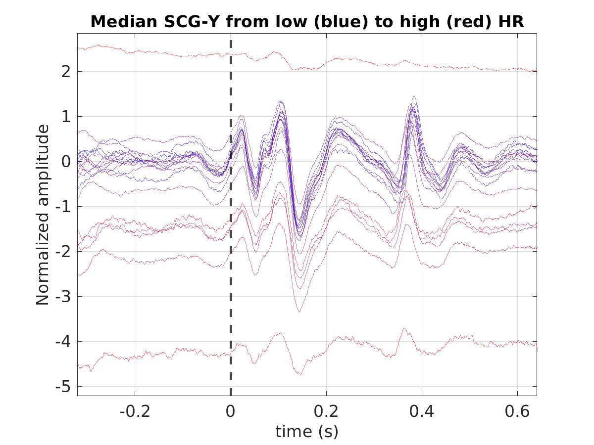 S020_scg_med_scgy_hr_binned_norm