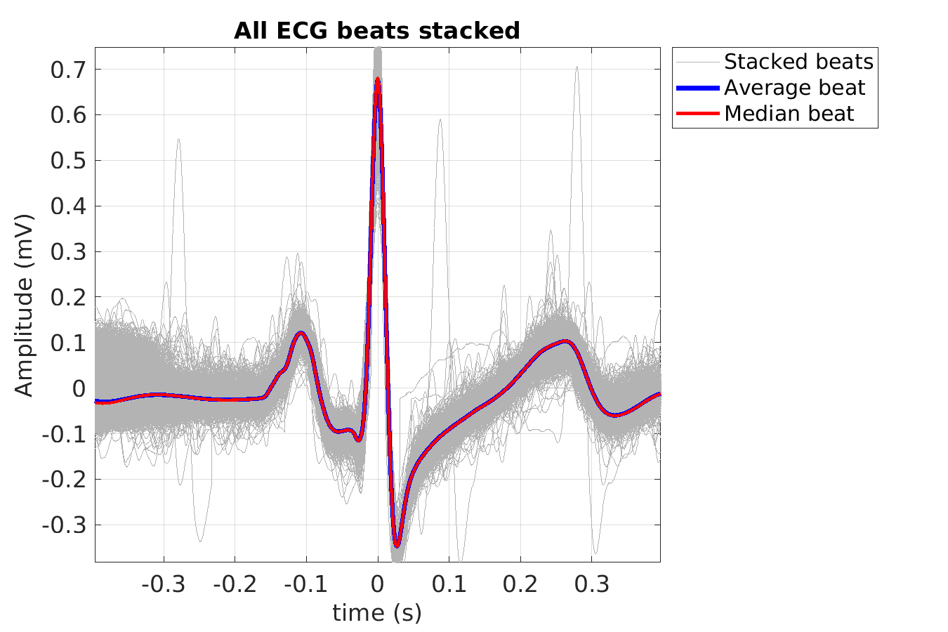 S021_ecg_beats_stacked