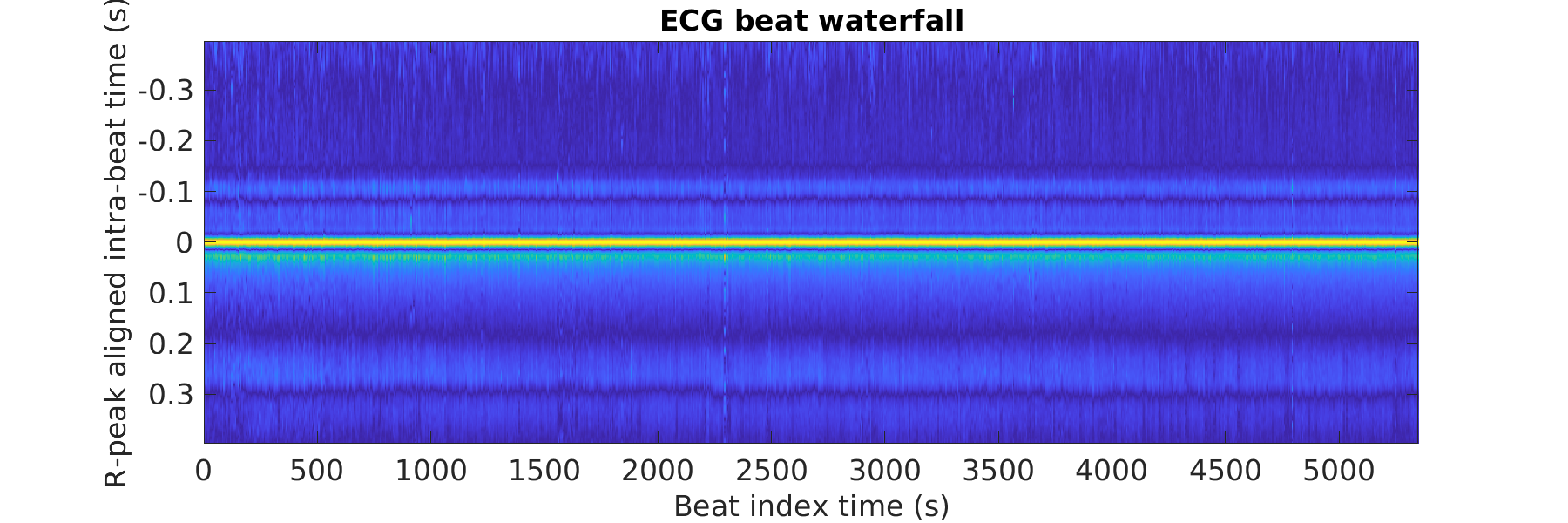 S021_ecg_beats_waterfall