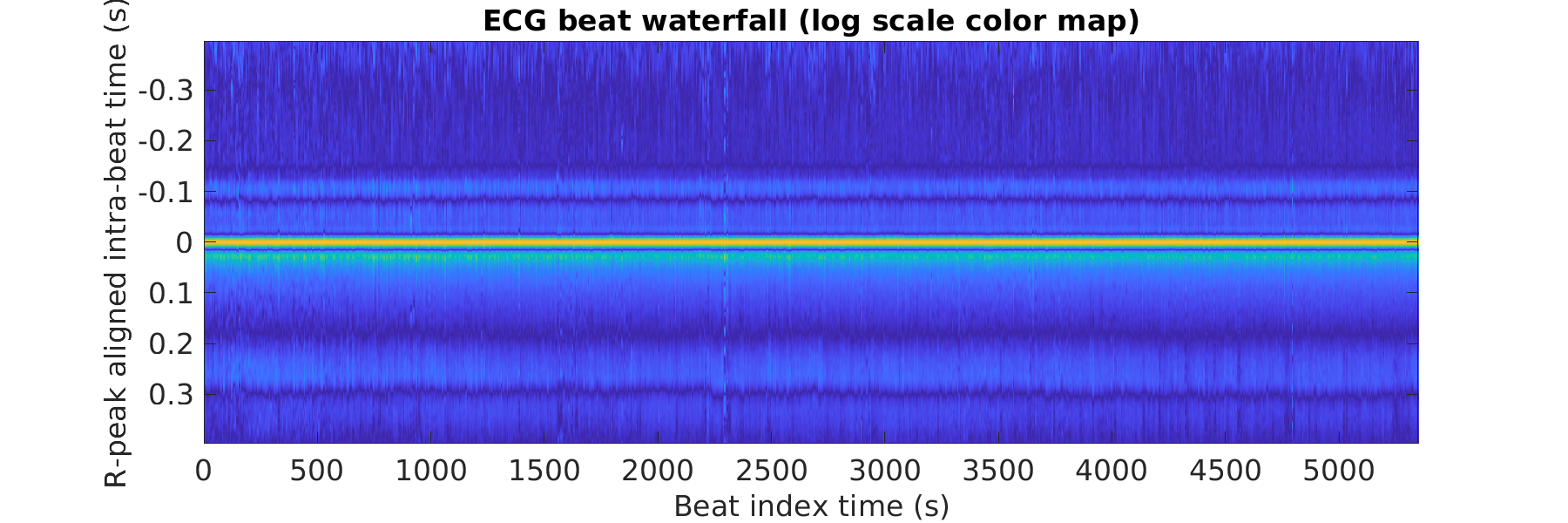 S021_ecg_beats_waterfall_logscale