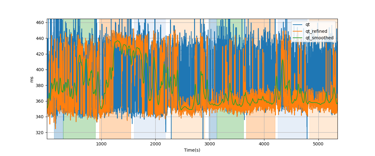 QT intervals - Overlay