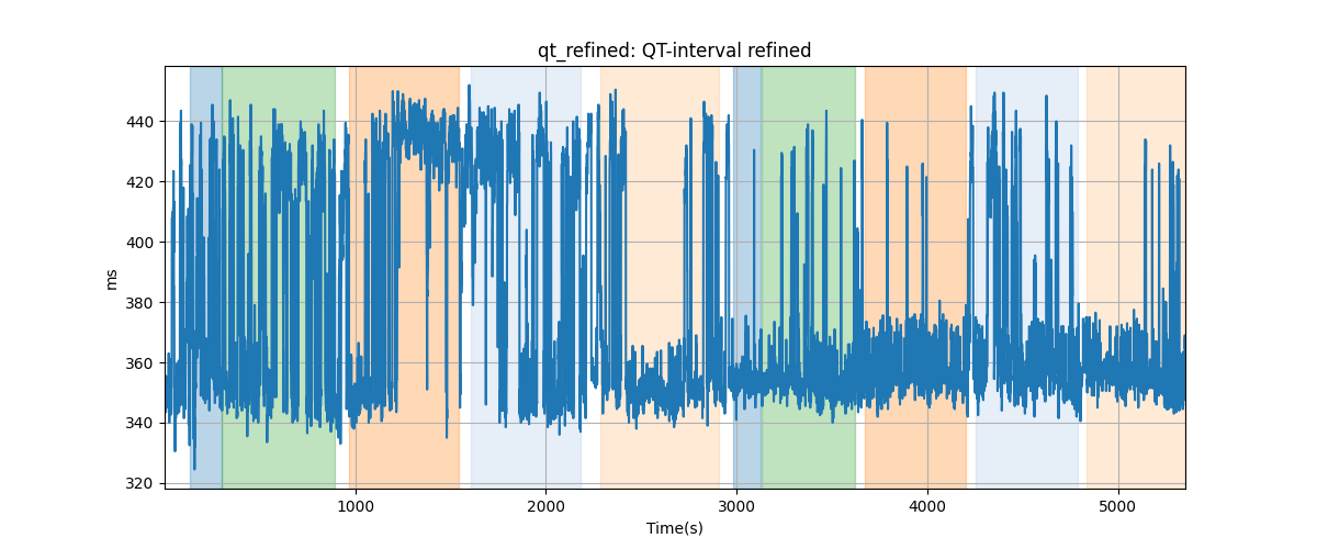 qt_refined: QT-interval refined