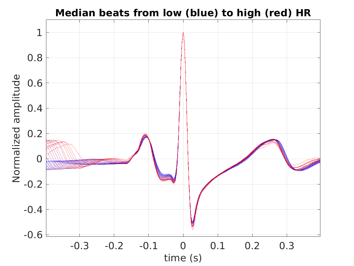 S021_ecg_med_beats_hr_binned