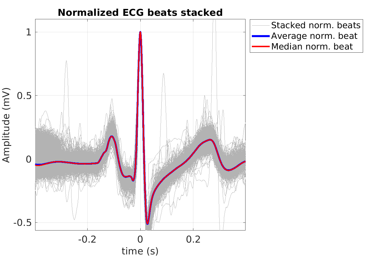 S021_ecg_norm_beats_stacked